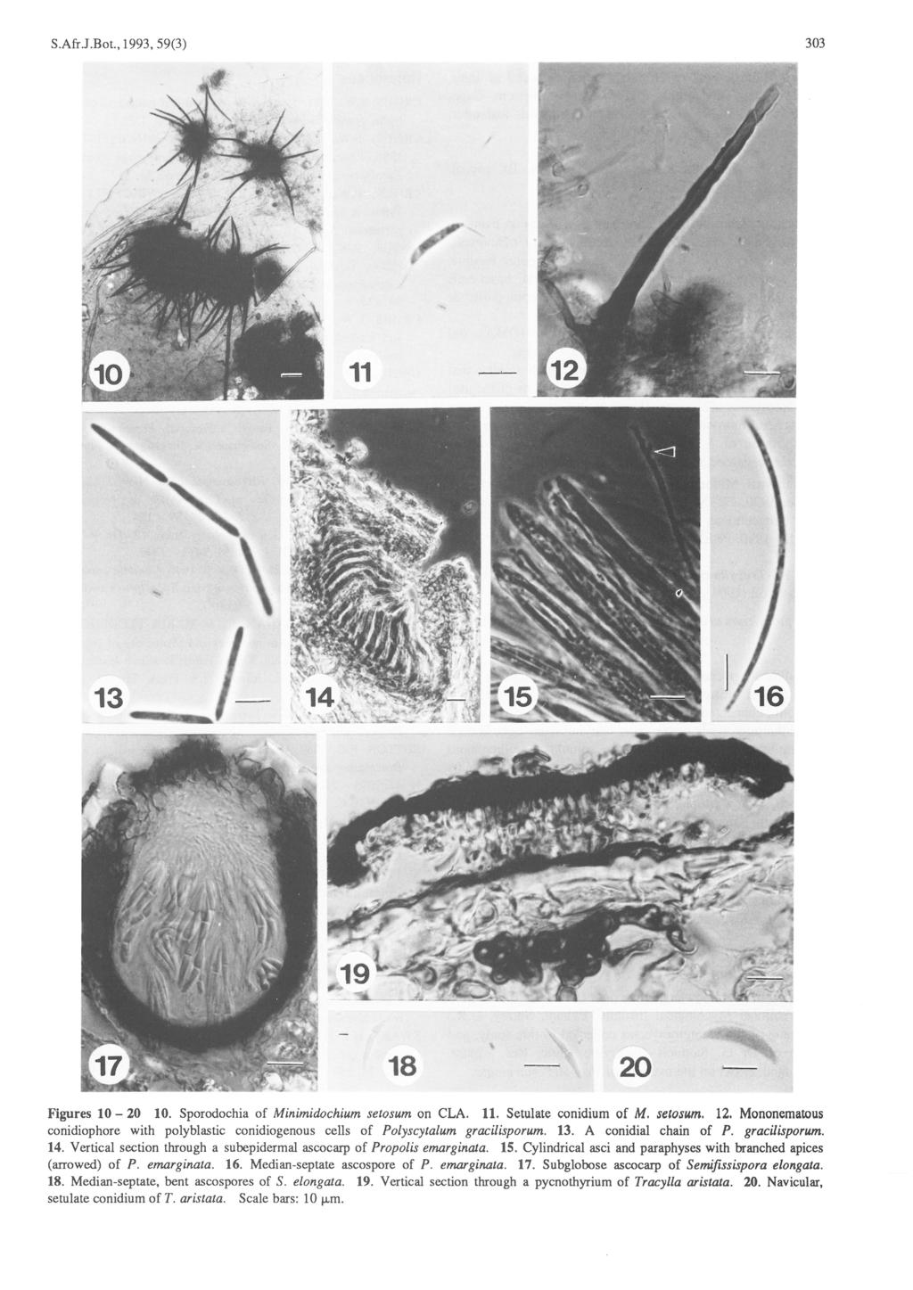 303 S.Afr.J.Bot., 1993, 59(3) J J 13... ~ \ 18 20 Figures 10-20 10. Sporodochia of Minimidochium setosum on CLA. 11. Setulate conidium of M. se&osum. 12.