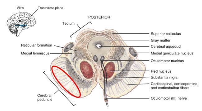 Tectum : the dorsal part (posterior) of the midbrain.and it is responsible for auditory and visual reflexes.
