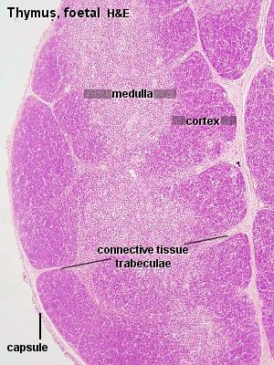 Thymus Unilateral (developmental) or