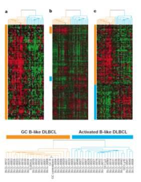 DLBCL: cell of origin subtypes Molecular Profiling in