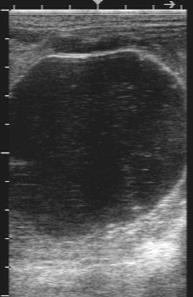 A wide variety of ovarian abnormalities are encountered in clinical practice Common Problems Anovulatory follicles Persistent anovulatory follicles Hemorrhagic/Luteinized follicles Persistent corpus