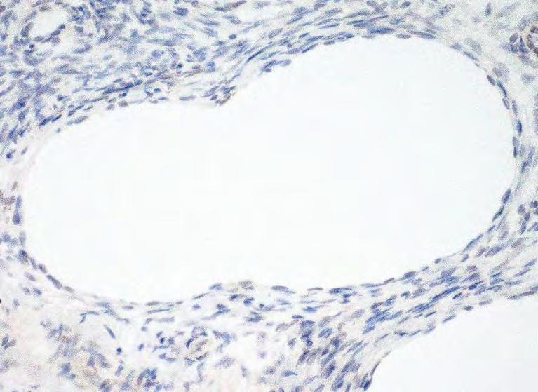 Thawed ovary 244 A few stromal cells and endothelial cells