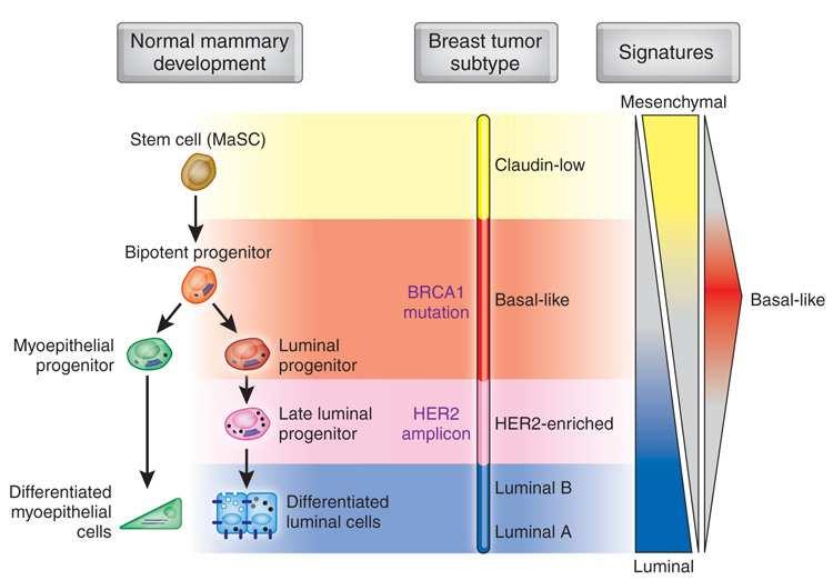 Origin of Breast Cancer Subtypes Pathways Underlying Aggressive Breast Cancers
