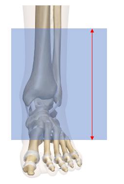 Capture from the heel to the distal part of Capture the entire femoral head of the the tibia (10cm above the ankle). Ensure the operative leg malleoli is captured of the operative leg.