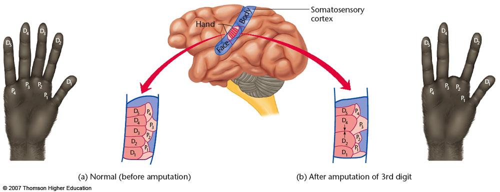 Phantom Pain Phantom pain and sensation commonly occur following amputation