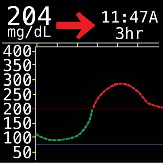 Teaching your Sensor: Example 1. Example 1: Here is an example of where the meter and CGM readings are off. Your meter reads 100 mg/dl and your CGM reads 204 mg/dl. How would you correct this?