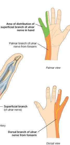 Lesion of ulnar nerve above elbow - Loss of cutaneous