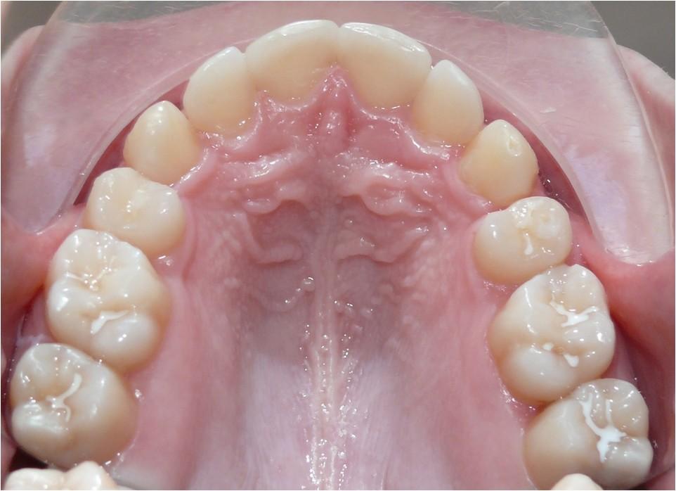 OCCLUSAL VIEW