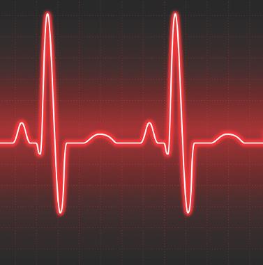 Atrial fibrillation may have no symptoms and only be noticed by feeling the pulse or by a health care professional testing the heart.