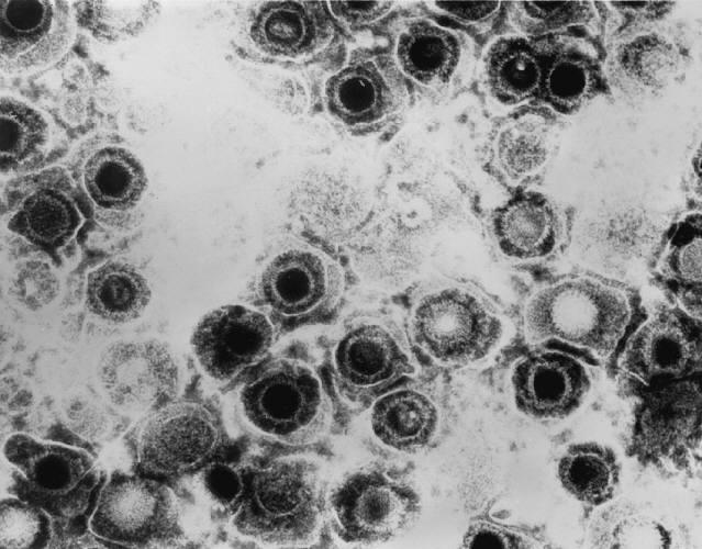Herpes viruses are a leading cause of human viral disease, second only to influenza