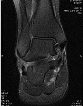 MRI T-2 image MRI T-1 image