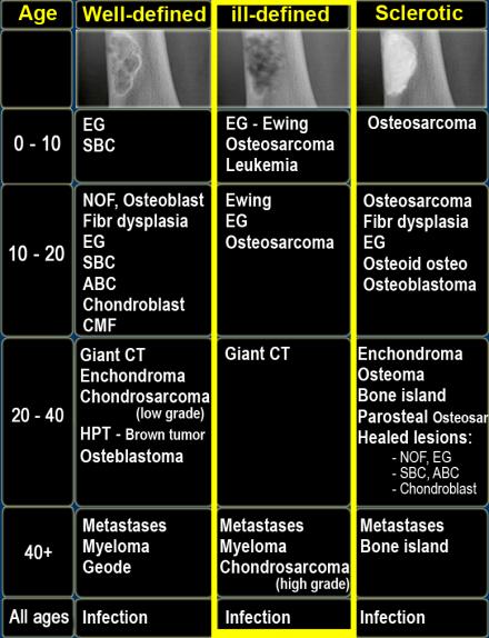 On the left a table with the most common bone tumors and tumor-like lesions in different agegroups. In the middle column common ill-defined osteolytic lesions.