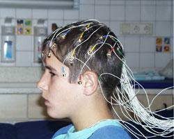 3. Electroencephalogram (EEG) An amplified recording of the waves of electrical activity that sweep across the brain s surface These waves