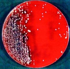 226 Failure of Vancomycin Treatment of Staphylococcus aureus Infection BJID 2003; 7 (June) Figure 1.