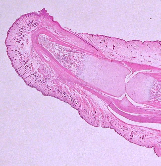Nail Bed Eponychium Hyponychium Distal Phalanx