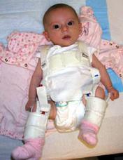 Pavlik harness Management: Infants Week 1-6 : 24h/day Week