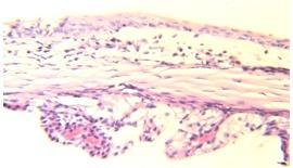 degeneration and necrosis in the covering epithelium of the