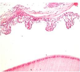 epithelial layer as shown in Figure (11) while the endothelial