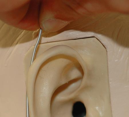 Bending the Ear Hook 1.