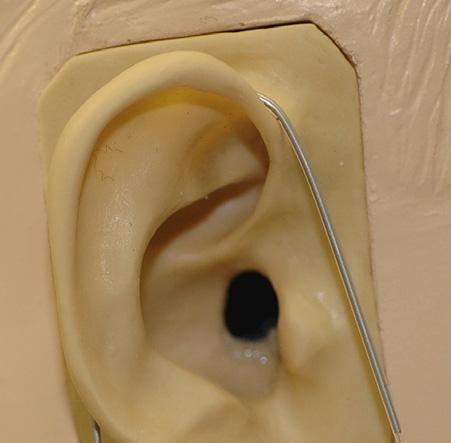 below the ear lobe. 5.