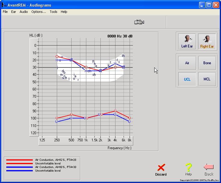 The audiogram was manually entered into the NOAHaud 3 software and saved 3.