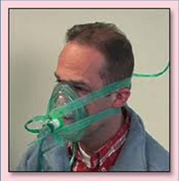 Positive Airway Pressure (CPAP)
