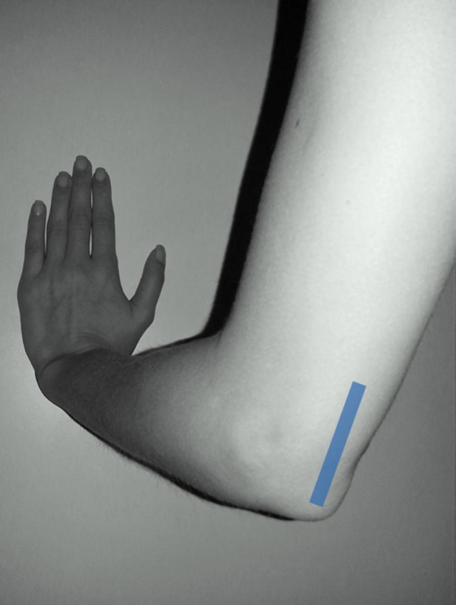 Fig. 17: Posterior elbow. Probe and patient position.