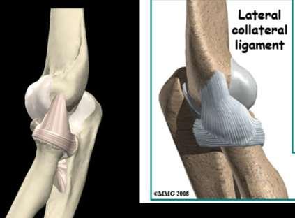 Radial Collateral Ligament (RCL) Thickened area in lateral joint capsule between the lateral epicondyle