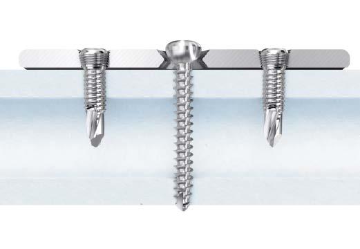 Internal fixation using a combination of locking screws and standard screws Note: If a combination of cortex and locking screws is used, a cortex screw should be inserted first to pull the plate to