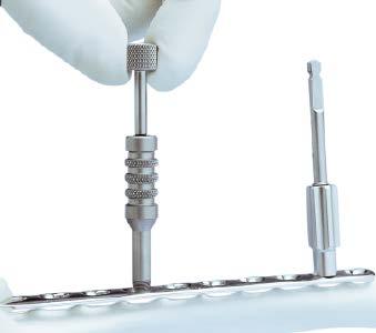 This becomes especially important when the plate has been contoured or applied in metaphyseal regions around joint surfaces. Figure 1 With the 2.8 mm threaded drill guide in place, insert the 1.