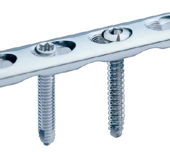 The DePuy Synthes Locking Compression Plate (LCP ) System is part of a stainless steel and titanium plate and screw system that merges locking screw technology with conventional plating techniques.