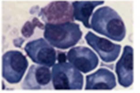 Rare cancers Multiple myeloma MTT Assay 50.0 GI50(μM) 40.0 30.0 20.