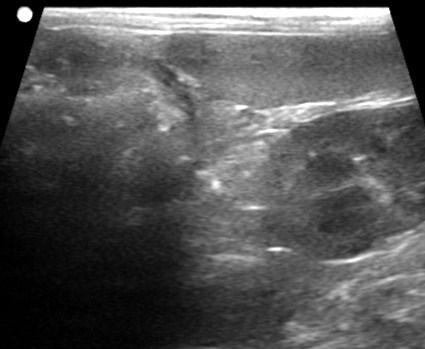 When scanning from a lateral approach the pancreas can be seen dorsal to the