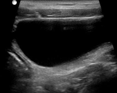 material is noted on the dorsal side of bladder stand the animal upright and revaluate the echogenic material (lesions will stay at the dorsal portion of bladder and debris should move to the