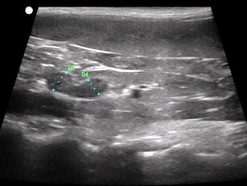 Use Color Doppler to follow the renal artery from the kidney If the dorsal position does not work, try to reposition the animal into a lateral recumbent positon You may have to