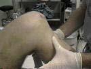 Posterior Drawer Test Knee is flexed to 90 degrees Push straight back on