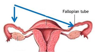 Fallopian Tubes