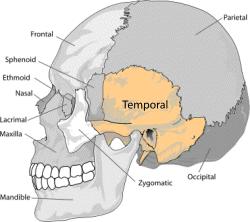 + Temporal Bone Occur in 14-22% of all skull base injuries Houses the