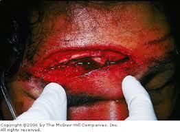 + Work-up & Associated Injuries Forehead swelling and