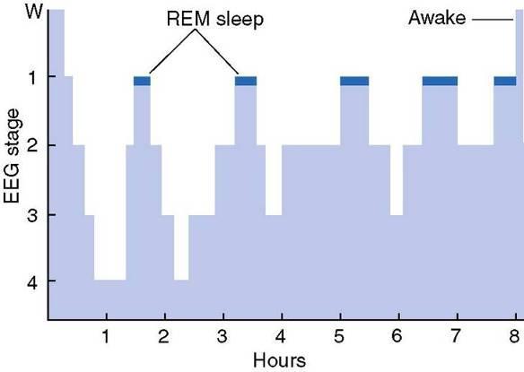 REM Sleep Approximately 70% of newborn infant s sleep is REM sleep. This declines to 30% by 6-months.