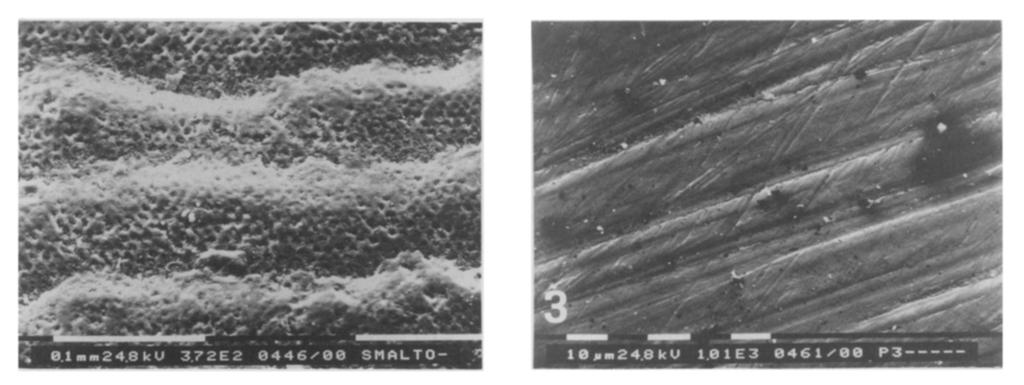 2 shows the enamel surface after treatment by means of a coarse diamond bur.