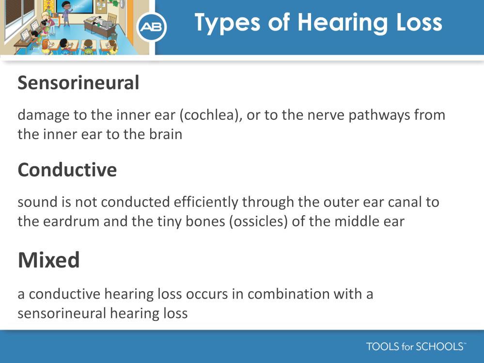 Speakers Notes: When we talk about a sensorineural hearing loss, we are referring to a loss of hearing function which occurs in the inner ear.