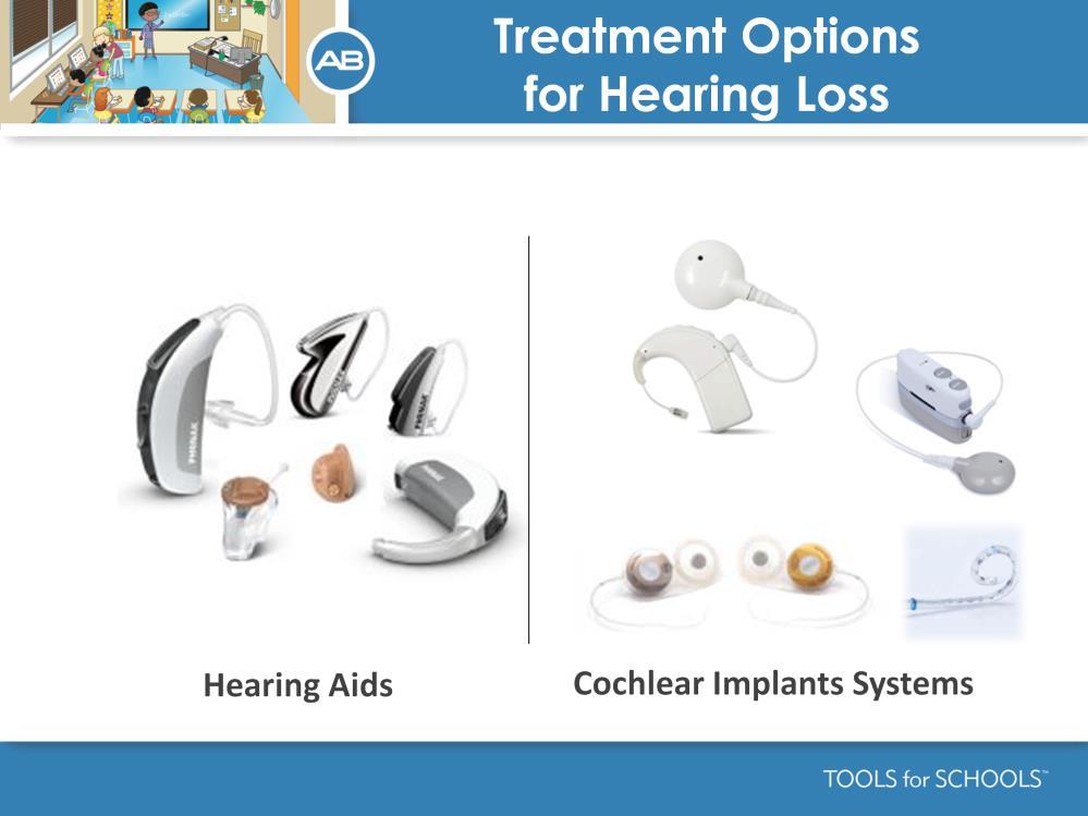 Speakers Notes: Pictured here are two options for hearing loss.