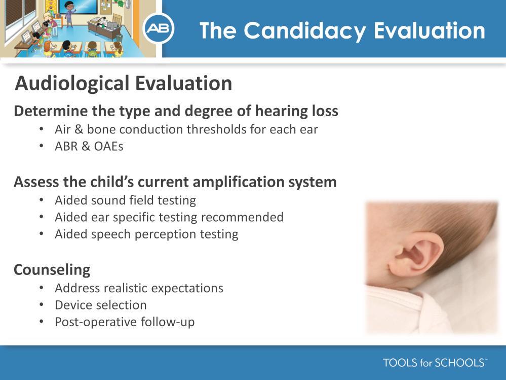 Speakers Notes: Now lets take a closer look at the cochlear implant evaluation. The audiologist will conduct several tests in order to best understand how the auditory system works.