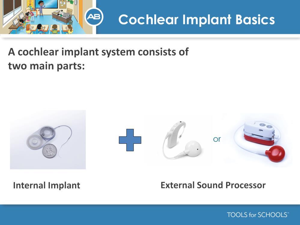Speakers Notes: Unlike a hearing aid, the cochlear implant system requires two