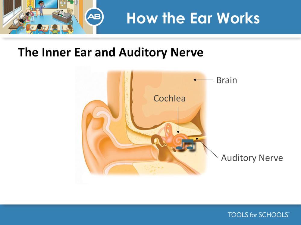 Speakers notes: The inner ear cochlea contains thousands of sensory cells bathed in fluid.