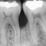 natural teeth-supporting structures have been regenerated.