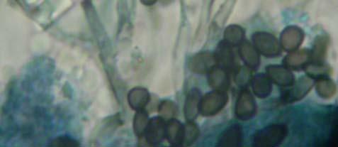 Conidiophores up to 50 µm long, arising from a runner like structure, and usually pale brown with a massive black deposit at the apex forming a cupulate collarette, 3-4 x 2.