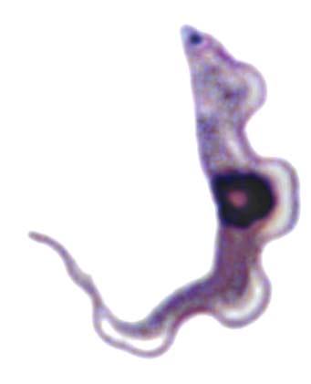 Detection of African Trypanosomes Blood examine on several days stained thin or thick smears fresh (characteristic