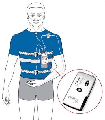 Portable Monitoring Airflow, thoraco abdominal